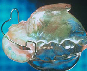 monoblok